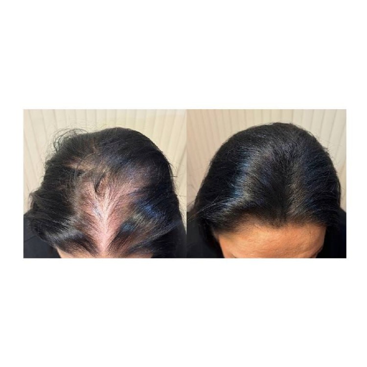 BioElixire Expert Mikrowłókna do zagęszczania włosów 30g.jpg